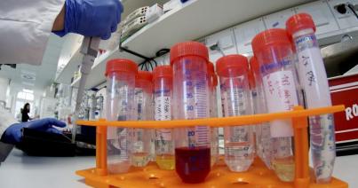 Koronavírus: az EU 10 millió eurót különít el kutatásokra