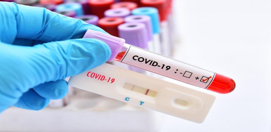Koronavírus – Az utóbbi héten 25 százalékkal emelkedett a fertőzésszám