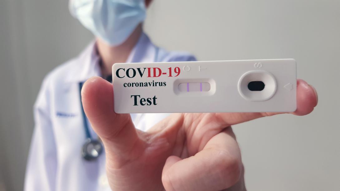 Covid-19: lassan javulnak  a járványügyi adatok
