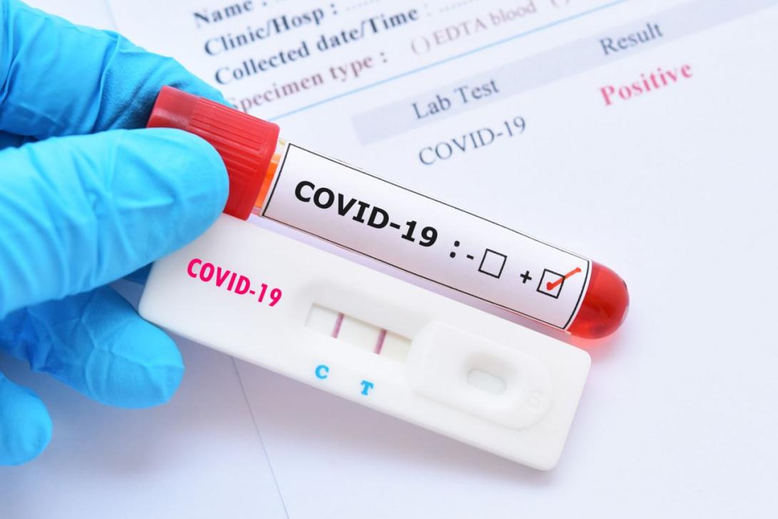 Feleannyi koronavírusos  esetet igazoltak hétvégén