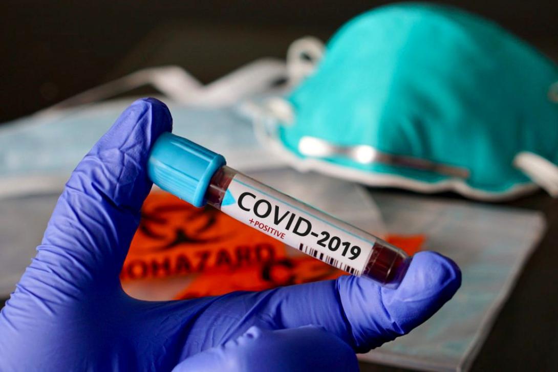 Nagyon magas a koronavírus-tesztek pozitivitási aránya